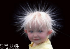 少年白什么原因？焦慮緊張會得病
