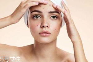 痘痘反復(fù)長(zhǎng)是什么原因？基礎(chǔ)護(hù)膚不夠用心
