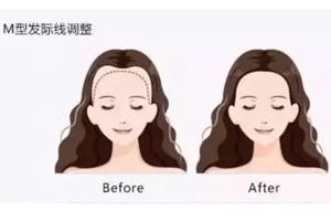 發(fā)際線粉填充和發(fā)際線筆哪個(gè)好？配合使用才最完美
