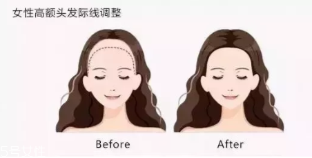 發(fā)際線粉填充和發(fā)際線筆哪個好？配合使用才最完美