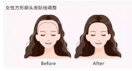 發(fā)際線粉填充和發(fā)際線筆哪個好？配合使用才最完美