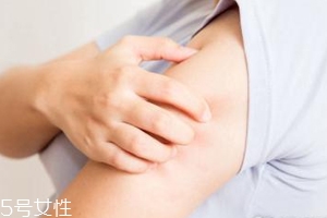 身體皮膚干燥用什么護(hù)膚品？這些身體乳拯救爆皮掉屑