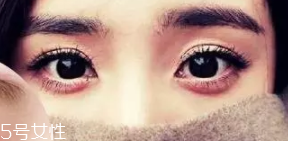 臥蠶和眼袋的區(qū)別是什么？臥蠶是肌肉眼袋是肥肉