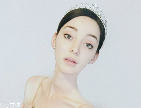 法令紋填充需要幾只玻尿酸？千萬不可過量