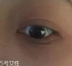 黑眼圈用什么眼霜好？多效護(hù)理型眼霜是首選