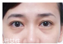 黑眼圈用什么眼霜好？多效護(hù)理型眼霜是首選