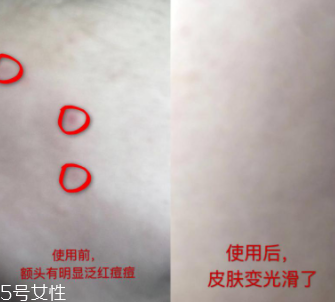 資生堂紅腰子適合什么年齡？最適合30歲以下人群