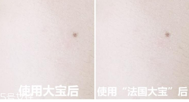 范爺同款法國大寶Embryolisse和大寶SOD蜜哪個好用？