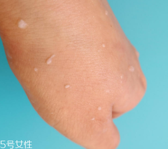 rosette去角質(zhì)凝膠怎么樣？真正的去角質(zhì)產(chǎn)品