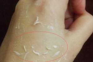 去角質(zhì)凝露多久用一次？皮厚一周一次