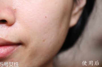 悅木之源和伊麗莎白雅頓哪個好？兩款精華大比拼