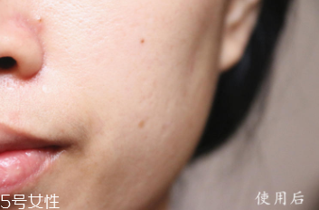 悅木之源和伊麗莎白雅頓哪個好？兩款精華大比拼