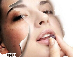 春季如何預(yù)防皮膚過(guò)敏？選擇敏感肌專(zhuān)用護(hù)膚品