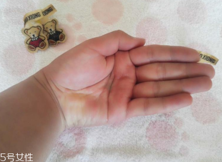 柳屋生發(fā)水有用嗎？一個月后長出新發(fā)