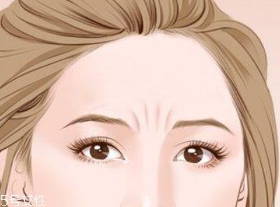 川字紋可以手術(shù)去除嗎？選擇手術(shù)需謹慎