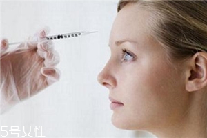川字紋可以打玻尿酸嗎？不是最佳選擇