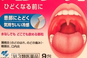 小林制藥扁桃體咽喉炎藥怎么用？