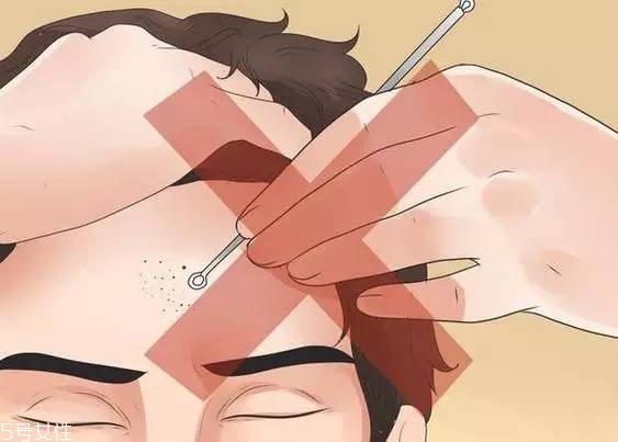 去黑頭產品推薦 臉上的黑頭就會少很多的小妙招