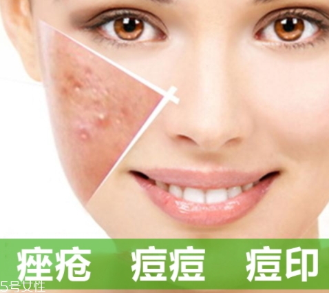 a酸怎么用？a酸怎么建立耐受？