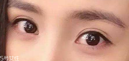 葉黃素能治療夜盲癥嗎？看什么類型的