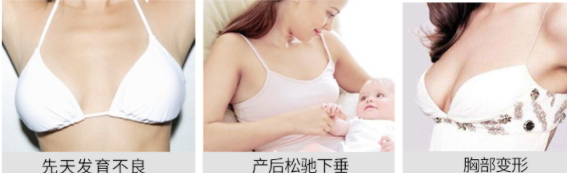 豐胸霜怎么用？豐胸霜使用手法詳解