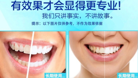 美白牙貼會反彈嗎？牙貼美白效果持續(xù)多久