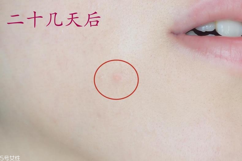 雅詩蘭黛晶透沁白防曬搖搖乳成膜快嗎？適合油痘皮嗎？