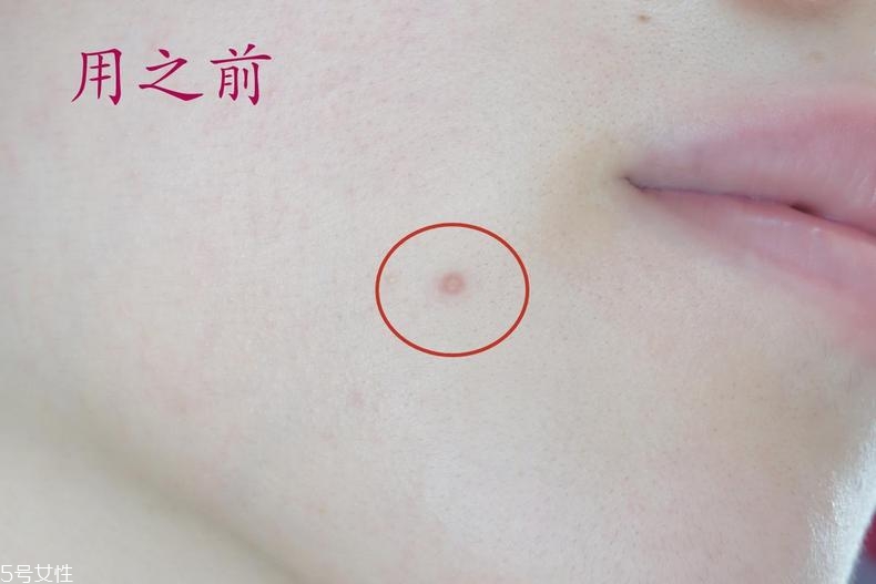 雅詩蘭黛晶透沁白防曬搖搖乳成膜快嗎？適合油痘皮嗎？