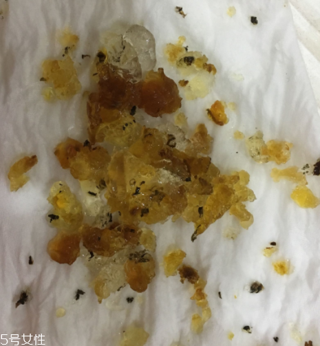 桃膠能和雞蛋一起吃嗎？桃膠配雞蛋可以嗎？