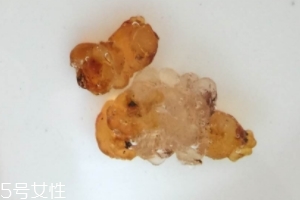 桃膠可以用開水泡嗎？用開水泡桃膠好嗎？