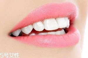 超聲波潔牙牙齒會變白嗎？超聲波潔牙心得