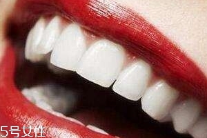 冷光美白會反彈嗎？冷光美白心得