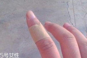 創(chuàng)可貼可以消腫嗎？創(chuàng)可貼有消腫功效嗎？