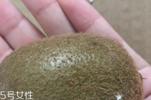 綠心獼猴桃含葉酸嗎？綠心獼猴桃里面有葉酸嗎？