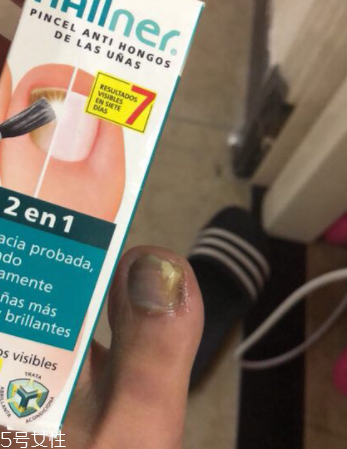 灰甲清有副作用嗎？灰甲清有哪些副作用？