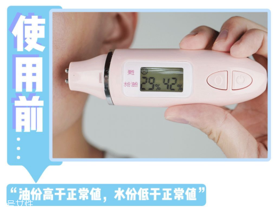 嬌韻詩(shī)不死鳥水精華適合油皮嗎 嬌韻詩(shī)不死鳥水精華油嗎