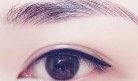 提眉和雙眼皮一起做嗎？提眉和雙眼皮要隔開(kāi)多久