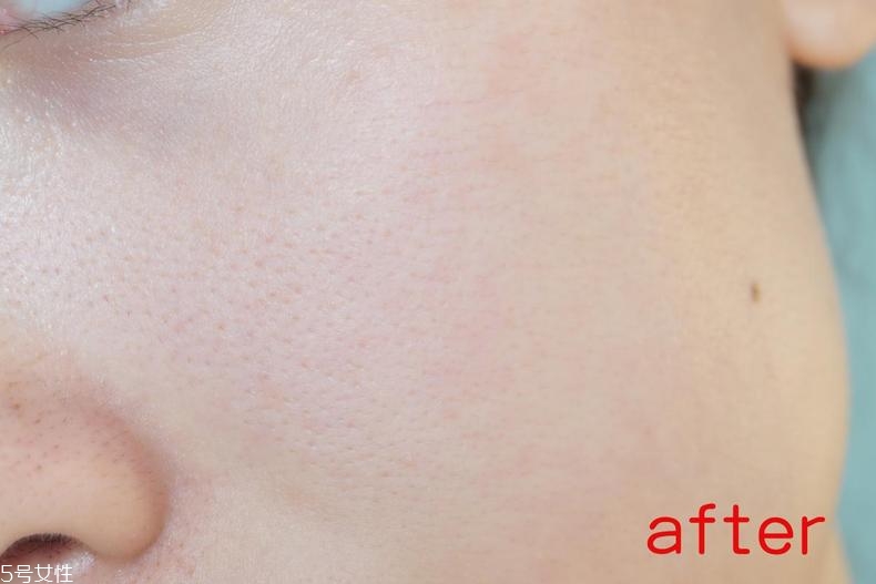 radha beauty vc精華白天能用嗎？敏感肌能用嗎？