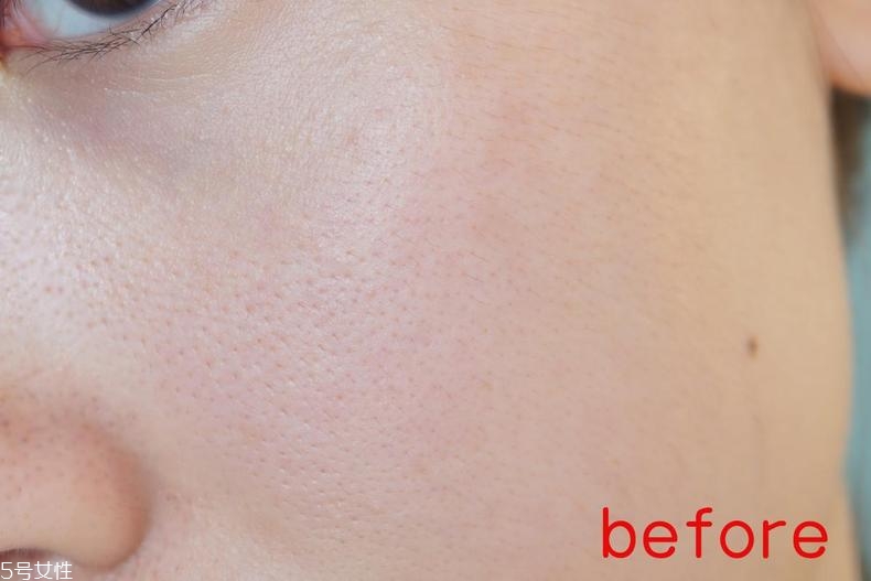 radha beauty vc精華白天能用嗎？敏感肌能用嗎？