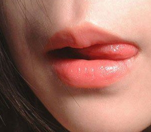 兔唇修復(fù)要多少錢？兔唇修復(fù)風(fēng)險(xiǎn)大嗎
