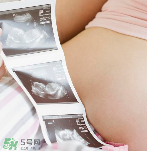 頭胎雙胞胎還能生二胎嗎？雙胞胎家庭能要二胎嗎？
