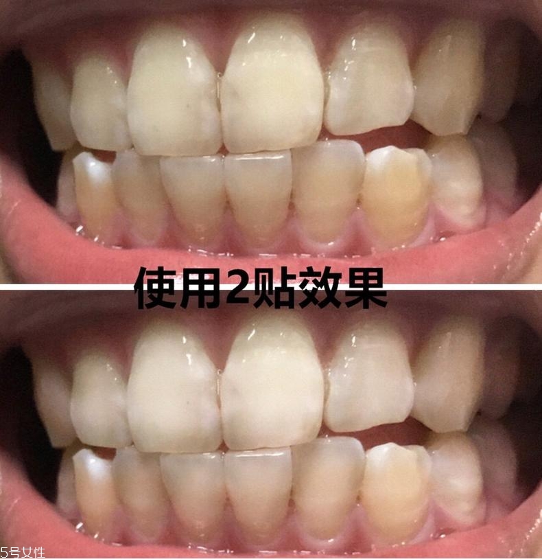 佳潔士美白牙貼貼多久有效？佳潔士美白牙貼使用感受