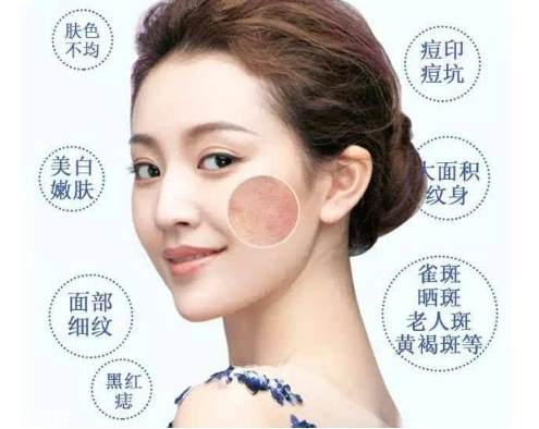 皮秒會(huì)反黑嗎 這是正?，F(xiàn)象