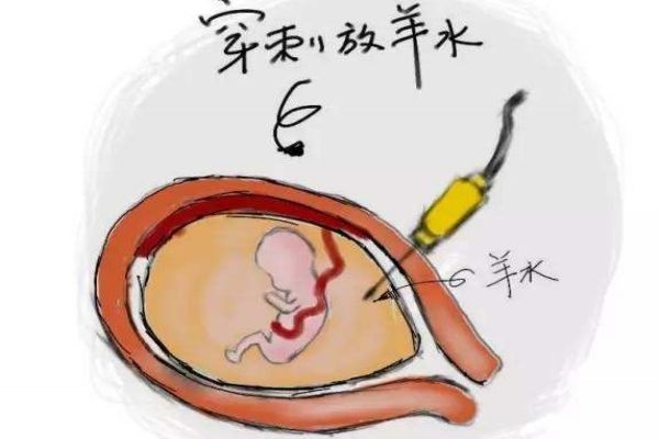 孕婦羊水過多對胎兒有害嗎 會(huì)危及胎兒性命