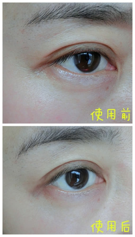 VIIcode夜間氧眼貼抗老效果怎么樣？VIIcode眼膜使用測(cè)評(píng)