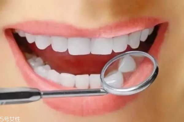 什么是支抗釘 打支抗釘有沒有風(fēng)險(xiǎn)