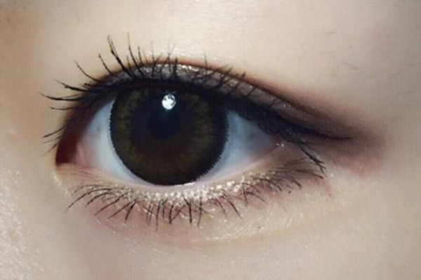 冬季做雙眼皮術好嗎 冬季做雙眼皮術恢復要多久