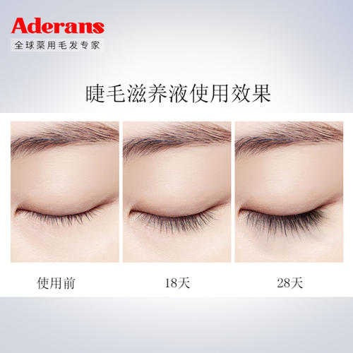 愛(ài)德蘭絲睫毛增長(zhǎng)液好用嗎 愛(ài)德蘭絲睫毛增長(zhǎng)液安全嗎