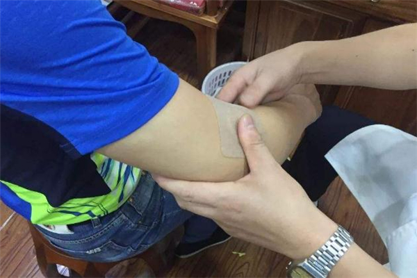 三伏貼一年四季都能貼嗎 三伏貼為什么貼了感覺(jué)涼