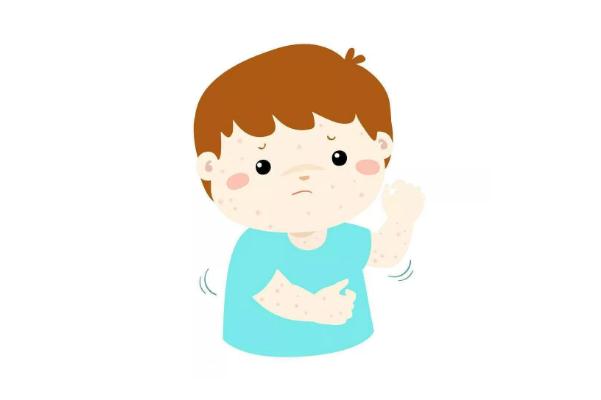 水痘會(huì)傳染給大人嗎 水痘會(huì)傳染給嬰兒?jiǎn)?>
<p class=